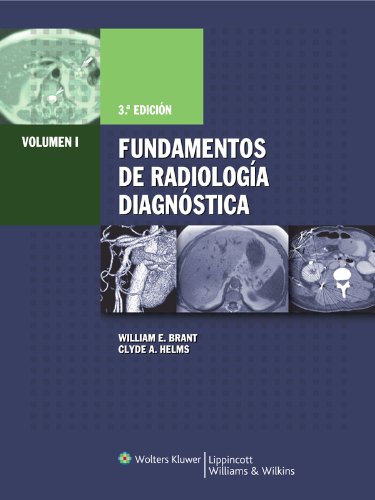 Fundamentos de Radiologia Diagnostica (Spanish Edition) by Clyde A. Helms