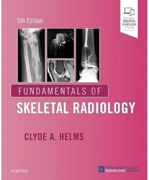 Fundamentals of Skeletal Radiology by Clyde A. Helms MD