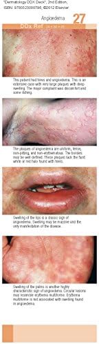 Dermatology DDX Deck by Thomas P. Habif MD