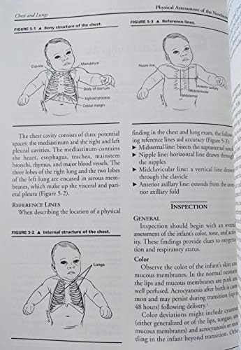 Physical Assessment of the Newborn: A Comprehensive Approach to the Art of Physical Examination by Mary Ellen Honeyfield