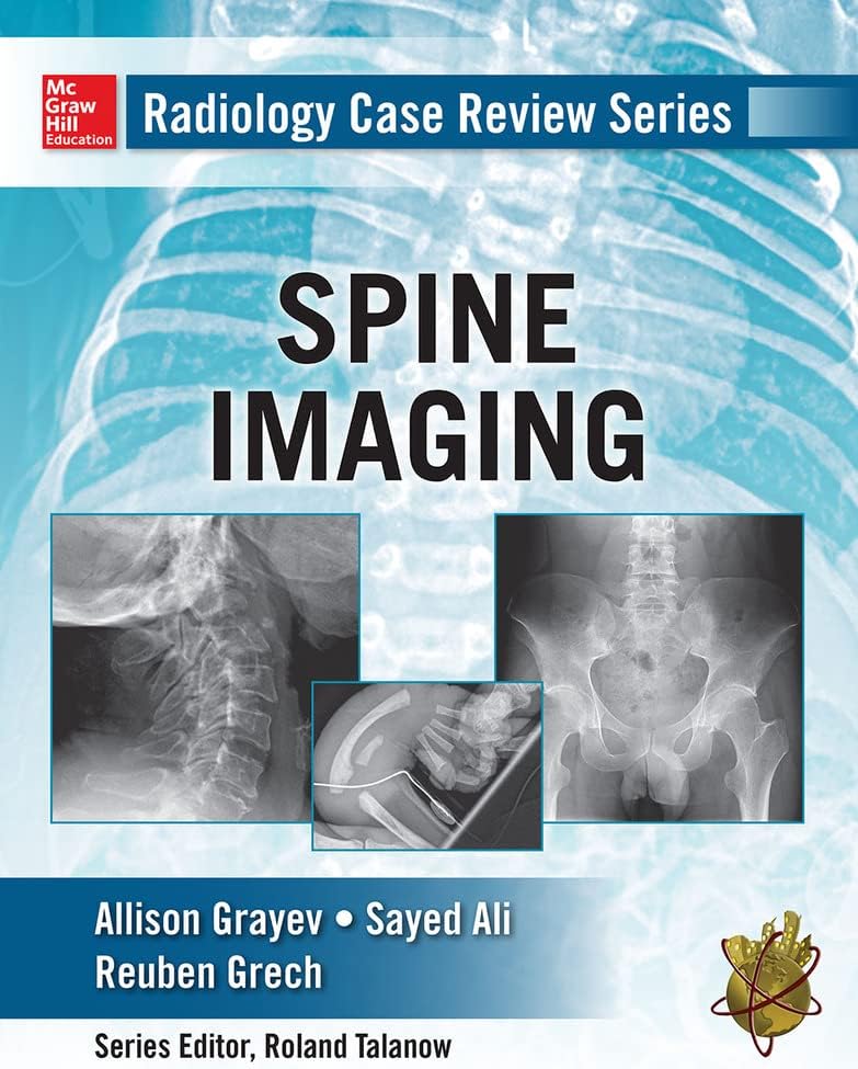 Radiology Case Review Series: Spine by Allison Michele Grayev