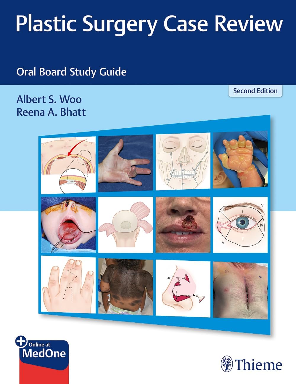 Plastic Surgery Case Review: Oral Board Study Guide by Albert S. Woo