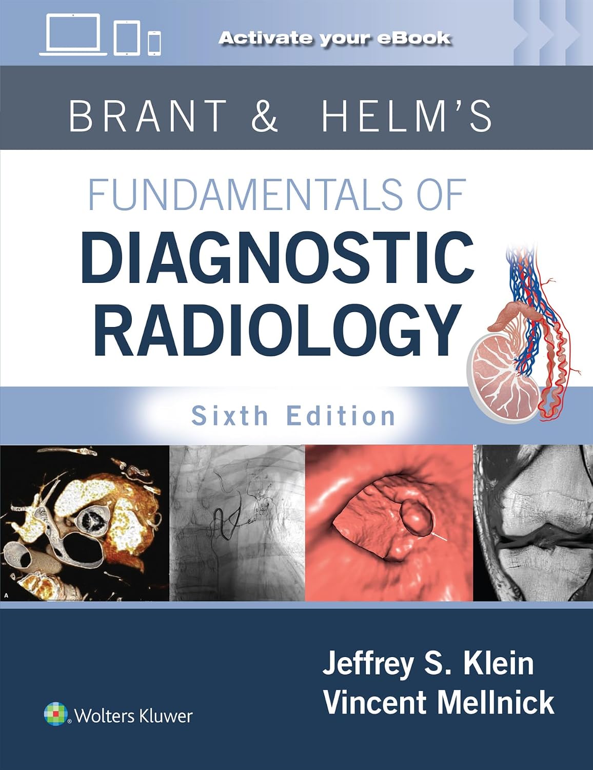 Brant & Helms' Fundamentals of Diagnostic Radiology: Print + eBook with Multimedia by Jeffrey Klein MD FACR