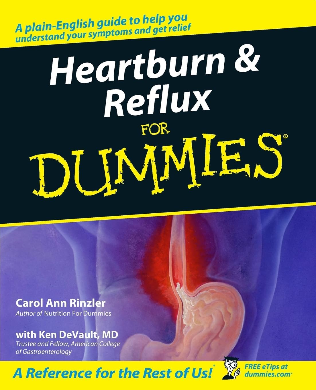 Heartburn and Reflux For Dummies by Carol Ann Rinzler