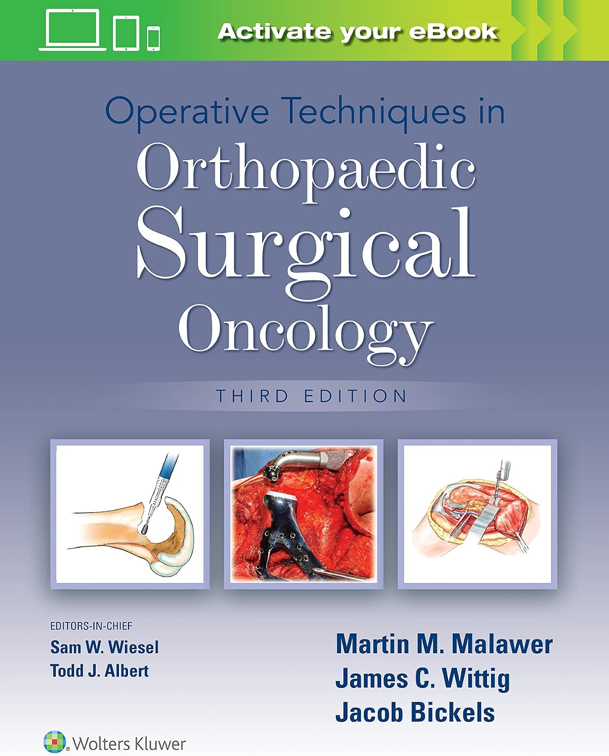 Operative Techniques in Orthopaedic Surgical Oncology by Martin M. Malawer