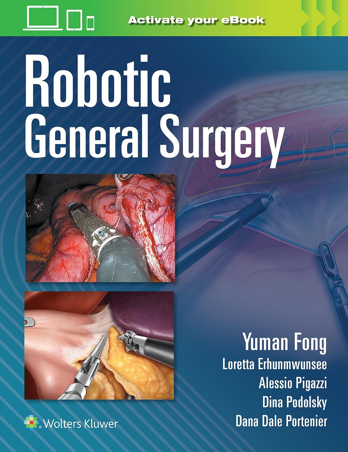Robotic General Surgery by Yuman Fong
