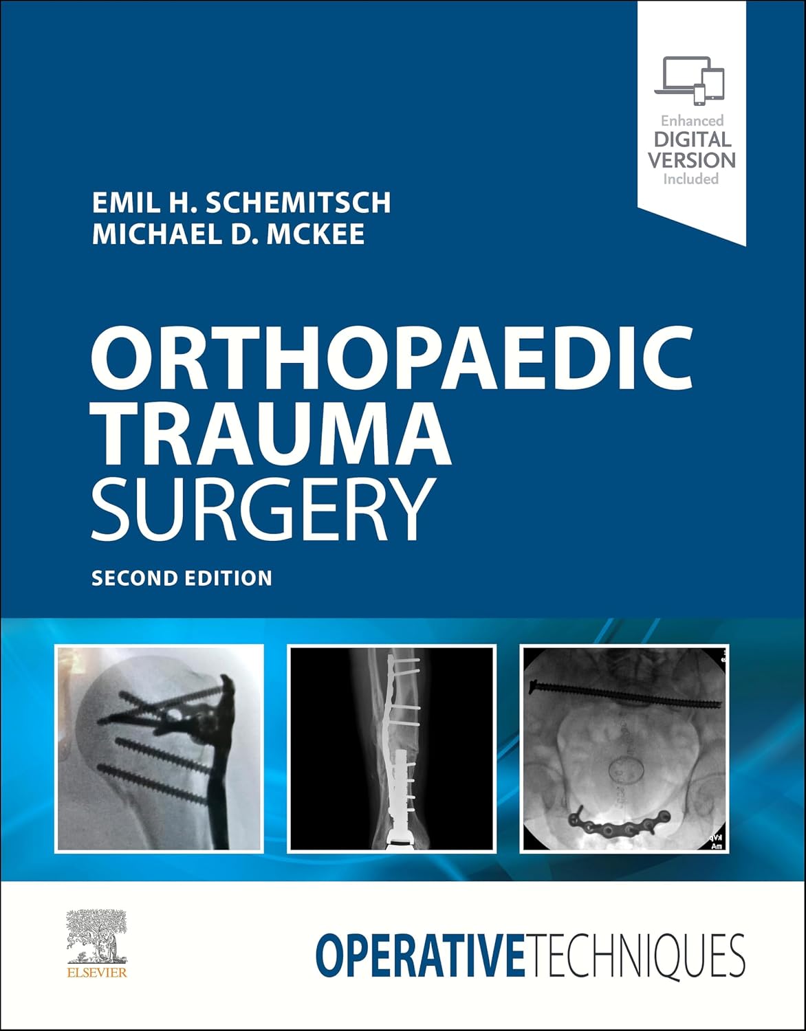 Operative Techniques: Orthopaedic Trauma Surgery E-Book by Emil Schemitsch
