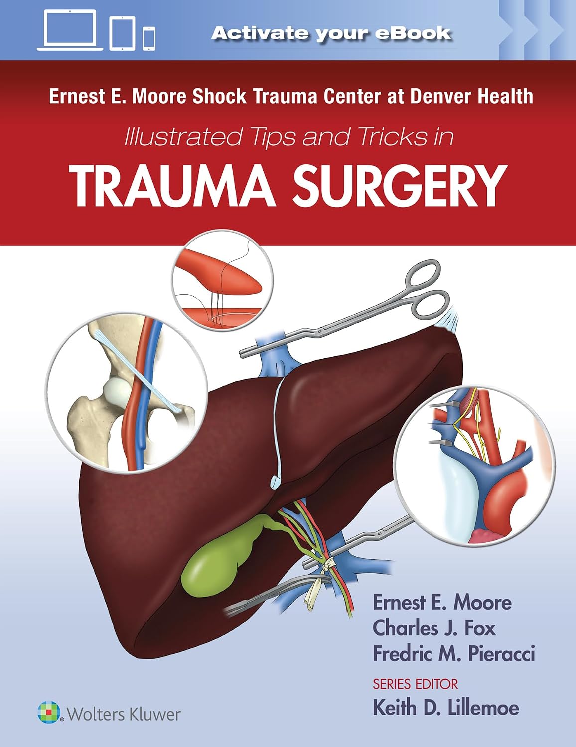 Ernest E. Moore Shock Trauma Center at Denver Health Illustrated Tips and Tricks in Trauma Surgery by Ernest E. Moore MD
