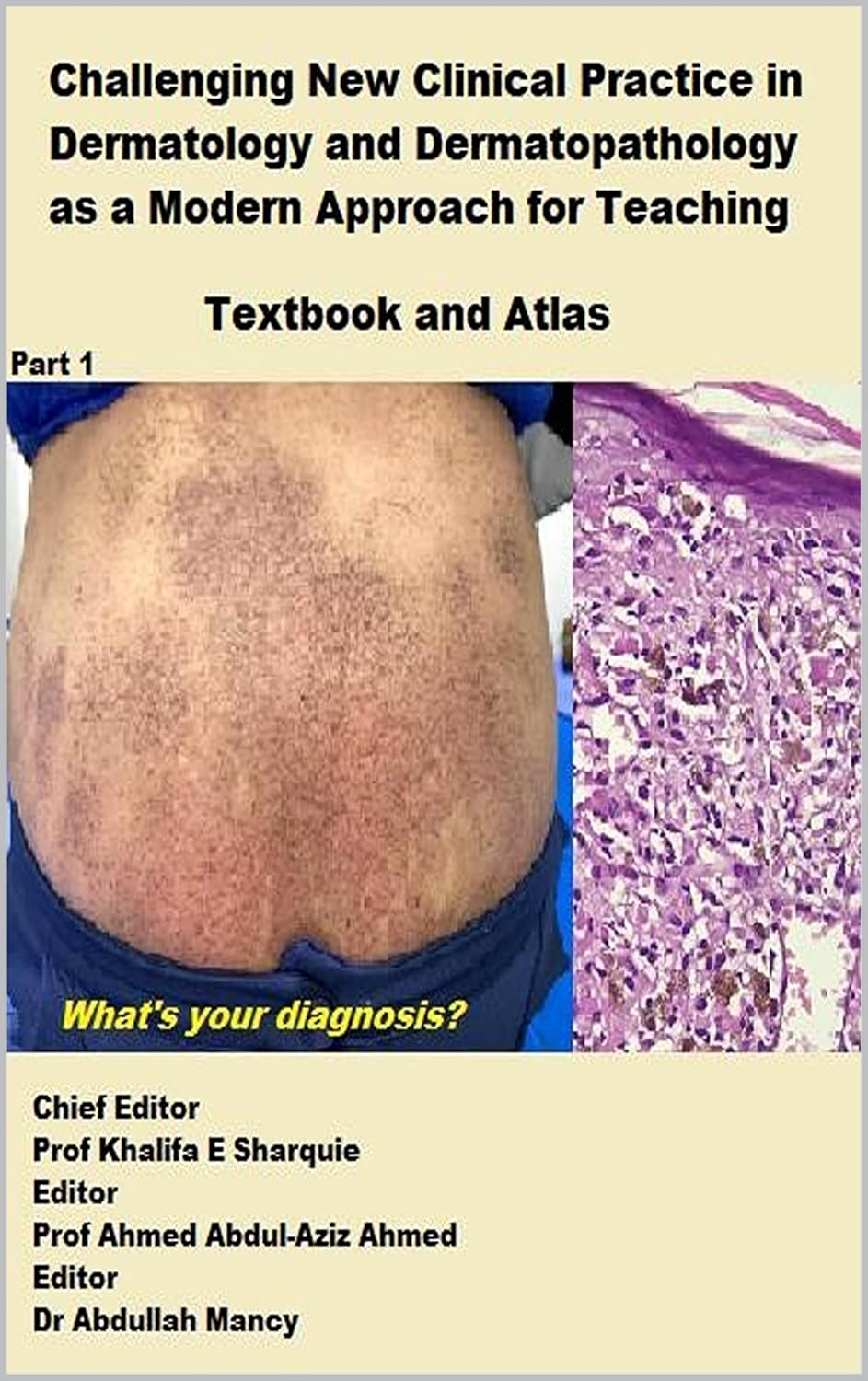 Challenging New Clinical Practice in Dermatology and Dermatopathology: A Modern Approach for Teaching Textbook and Atlas: Part one by Khalifa E Sharquie