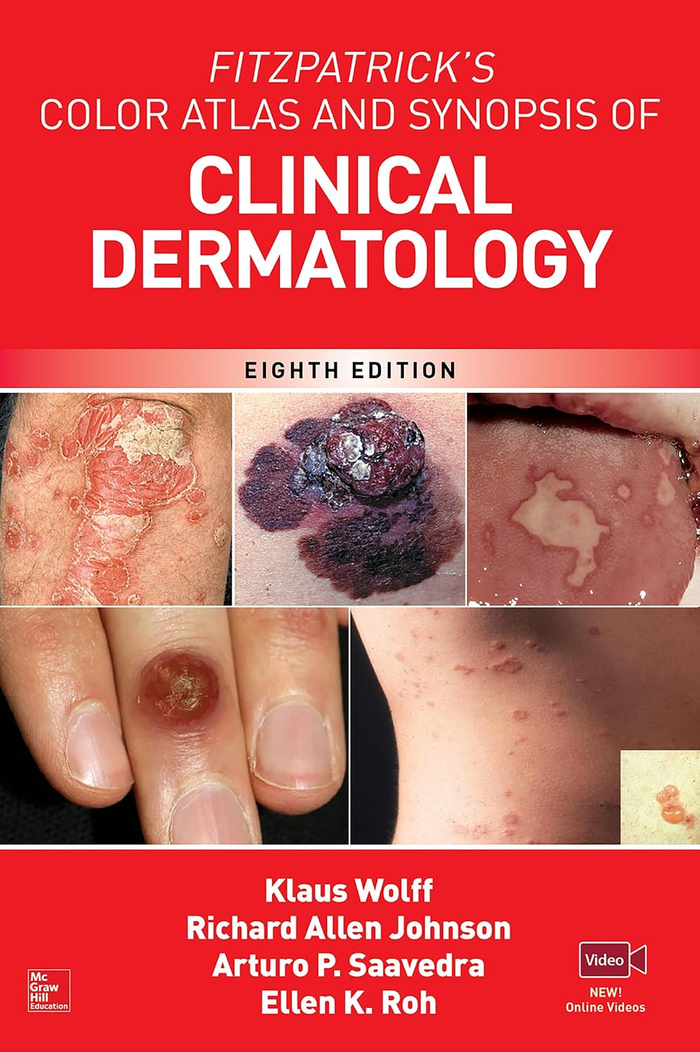 Fitzpatrick's Color Atlas AND SYNOPSIS OF CLINICAL DERMATOLOGY, 8th Ed by Klaus Wolff