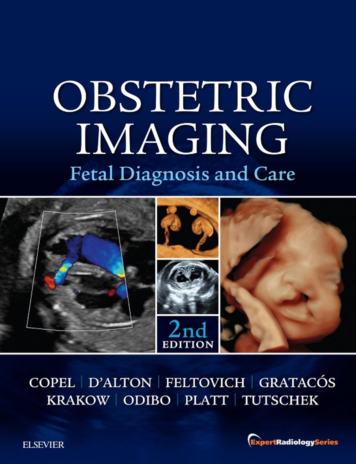 Obstetric Imaging: Fetal Diagnosis and Care E-Book: Expert Radiology Series by Joshua Copel MD