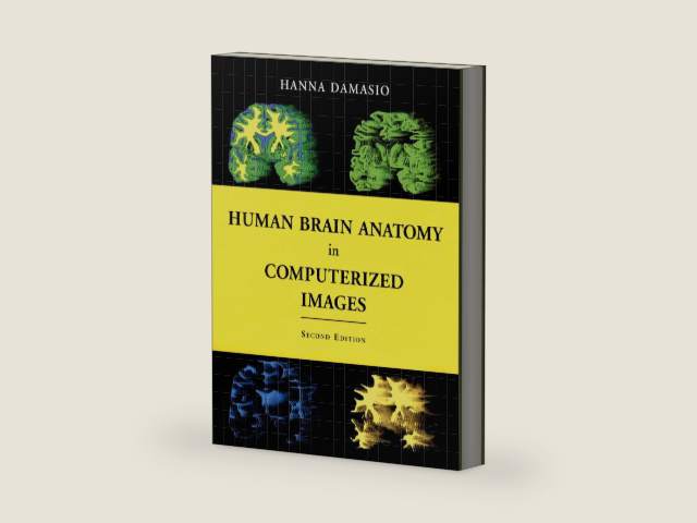 Human Brain Anatomy in Computerized Images by Hanna Damasio M.D.
