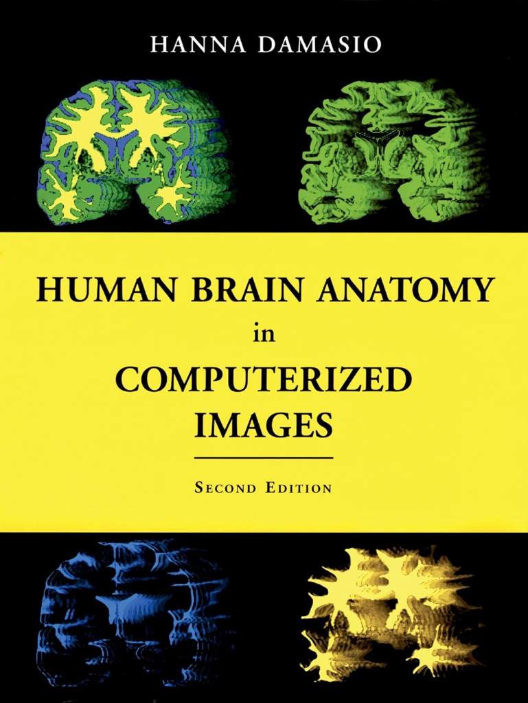 Human Brain Anatomy in Computerized Images by Hanna Damasio M.D.