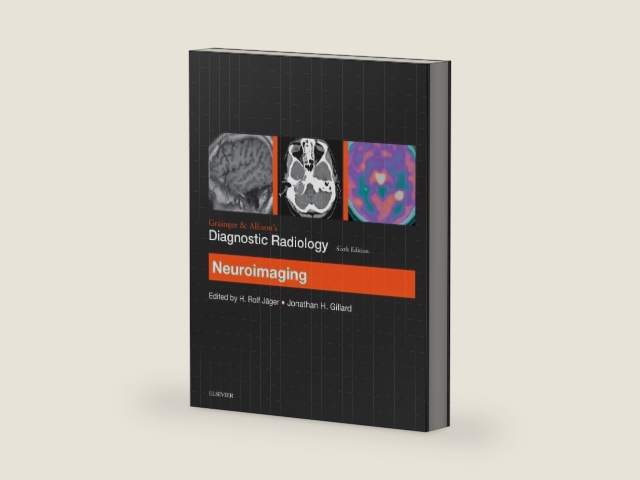 Grainger & Allison’s Diagnostic Radiology: Neuroimaging by H. Rolf Jager FRCR MD