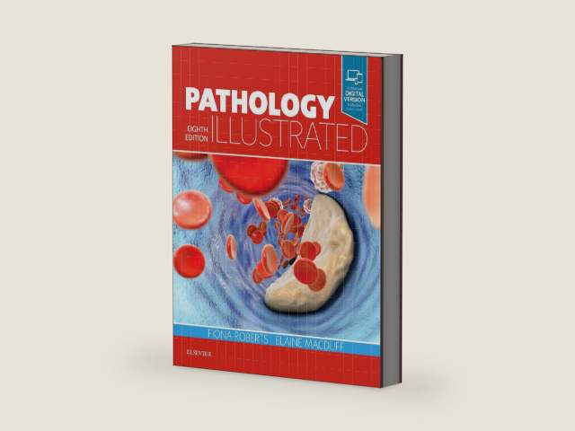 Pathology Illustrated by Fiona Roberts BSc MBChB MD FRCPath
