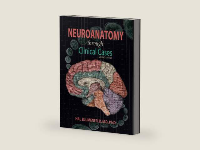 Neuroanatomy through Clinical Cases by Hal Blumenfeld
