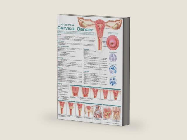 Understanding Cervical Cancer Anatomical Chart by Anatomical Chart Company