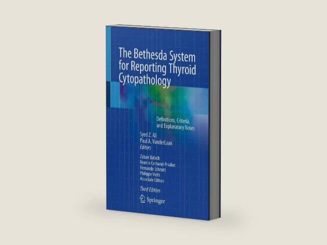 The Bethesda System for Reporting Thyroid Cytopathology: Definitions, Criteria, and Explanatory Notes by Syed Z. Ali
